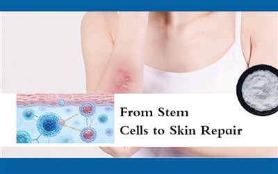 จากสเต็มเซลล์สู่การซ่อมแซมผิว