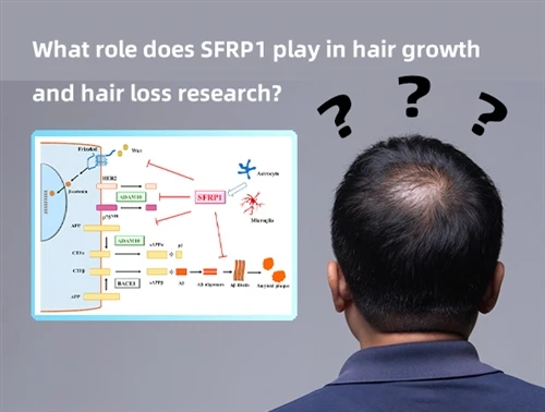 SFRP1 มีบทบาทอย่างไรในการวิจัยการเจริญเติบโตของเส้นผมและผมร่วง